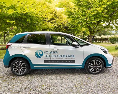 NZLTR Honda Jazz Car